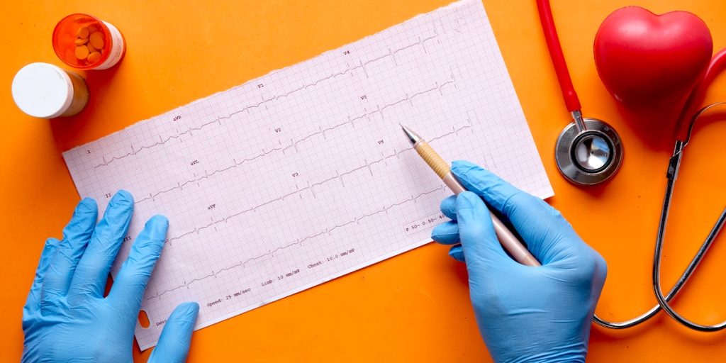 5 najvažnijih i najboljih dodataka prehrani za zdravlje srca 